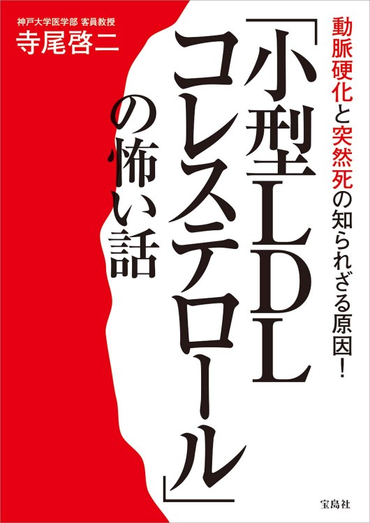 動脈硬化と突然死の知られざる原因！ 「小型LDLコレステロール」の怖い話