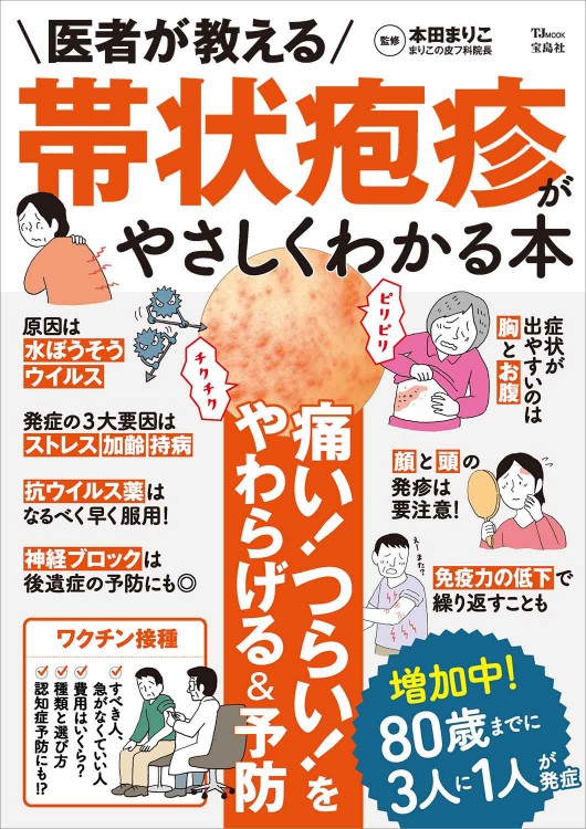 医者が教える 帯状疱疹がやさしくわかる本