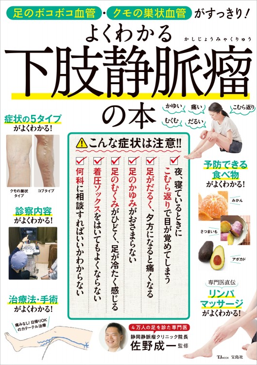 足のボコボコ血管・クモの巣状血管がすっきり！ よくわかる下肢静脈瘤の本